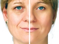 Yüz Kırışıklığına Bitkisel Çözüm Yöntemleri